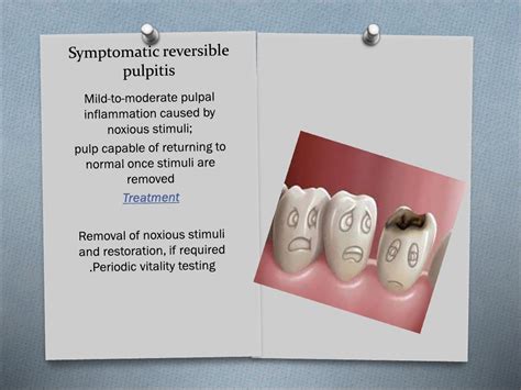 Endodontic emergencies pdf - د.عماد - Muhadharaty