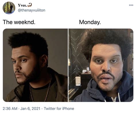 Monday | The Weeknd's Plastic Surgery Face | Know Your Meme