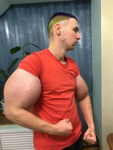 Meet Kirill Tereshin- Real Life Popeye Who Injected Synthol In His Cheeks