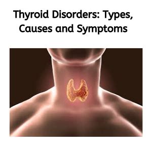 Thyroid Disorders: Types, Causes and Symptoms