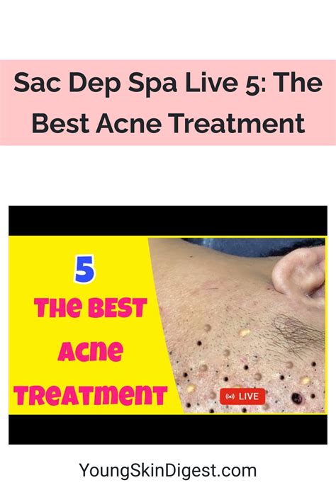 Sac Dep Spa Live 5: The Best Acne Treatment - Young Skin Digest