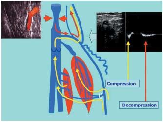 Saphenopopliteal junctions are significantly lower when incompetent. Embryological hypothesis ...