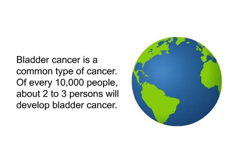 PatEdu.com : Bladder Cancer