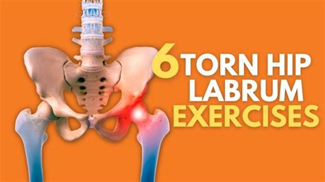 Top 6 Exercises For Naturally Healing A Painful Torn Hip Labrum in 2024 ...