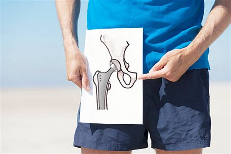 Joint Replacement Surgery - Great Lakes Orthopaedics