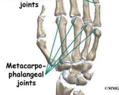 Metacarpophalangeal Joint | Bone and joint, Certified nursing assistant, Joint