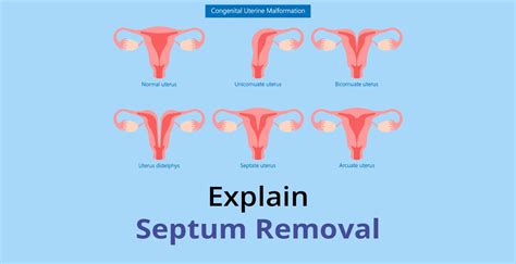 Uterine Septum: Symptoms & Treatment | Birla Fertility & IVF