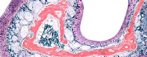 Nasal mucosal biopsy