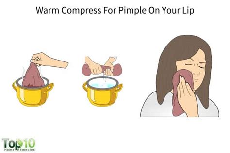 How to Get Rid of a Pimple on Your Lip | Top 10 Home Remedies