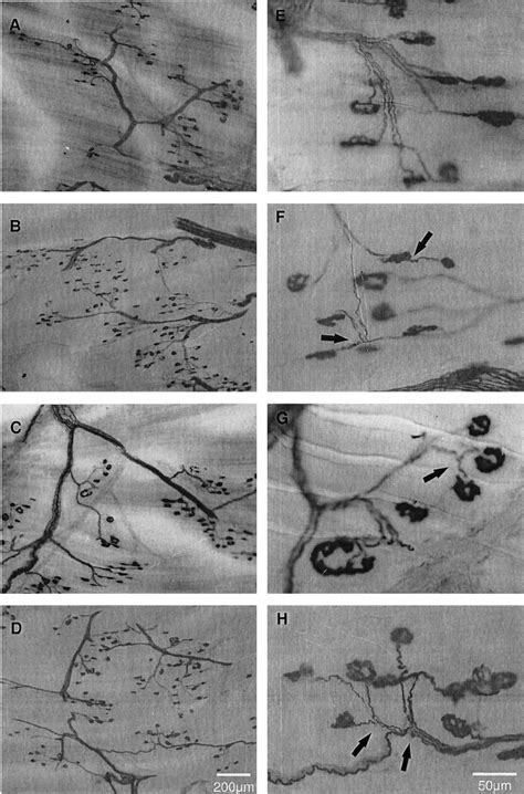 Photomicrographs of three different types of collateral sprouts ...