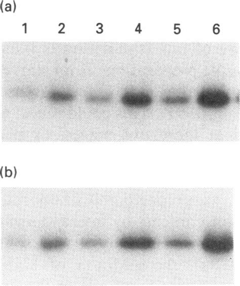 Preincubaton does not alter the sensitivity of p36 phosphorylatlon to ...