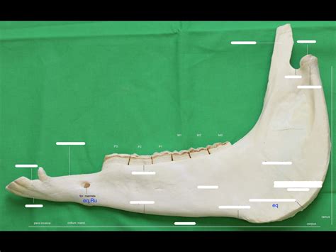 Mandibula Diagram | Quizlet