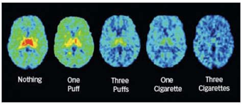 Nicotine Effects On Brain