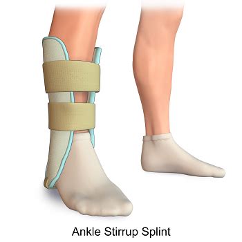 Tibia & Fibula Splints: Posterior Ankle & Bulky Jones | Study.com