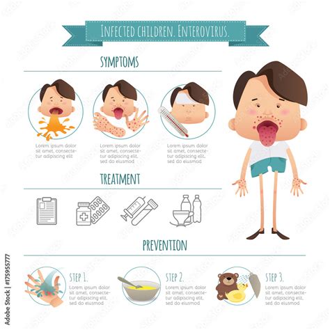 Infected children. Enterovirus. Hand-foot-mouth disease Infographics. Symptoms, prevention and ...