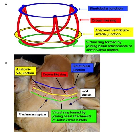 Aggregate more than 64 annular ring anatomy best - vova.edu.vn