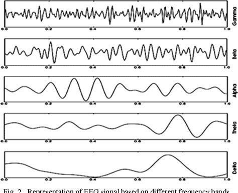 What Are The Possible Causes For An Abnormal Eeg: Unraveling The Brains ...