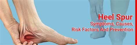 Heel Spur- Symptoms, Causes, Risk Factors and Prevention