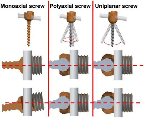 A biomechanical investigation of the retentive force of pedicle screw structures for different ...