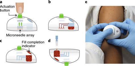 Collection of capillary blood samples with the TAP device a, When the ...