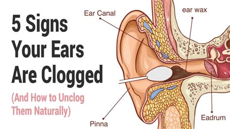 5 Signs Your Ears Are Clogged (And How to Unclog Them Naturally)