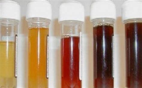 What The Color Of Your Urine Reveals About Your Health | Savvy Life Mag Plus