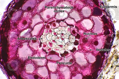 Pinus sp. Root. Endotrophic mycorrhiza. Transverse section. 500X - Root - Pinus sp. (Pine ...