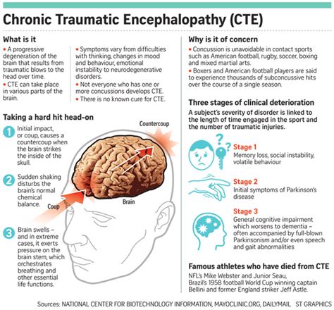 Overview of Concussion » Sports Concussion South Africa