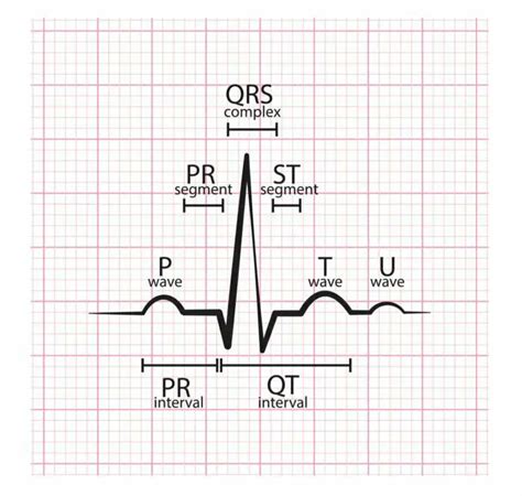 PR Interval: A Comprehensive Guide - Nursing Schools Near Me