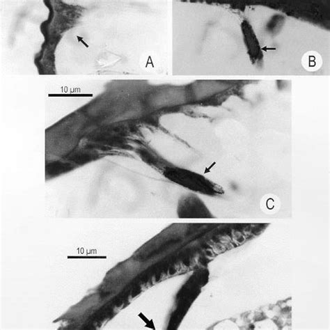 -A: scanning electron micrograph view of a Triatoma infestans fifth ...