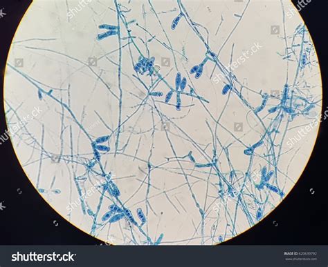 Macroconidia Epidermophyton Light Microscope Stock Photo 620639792 | Shutterstock