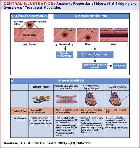 Myocardial Bridging: Diagnosis, Functional Assessment, and Management ...