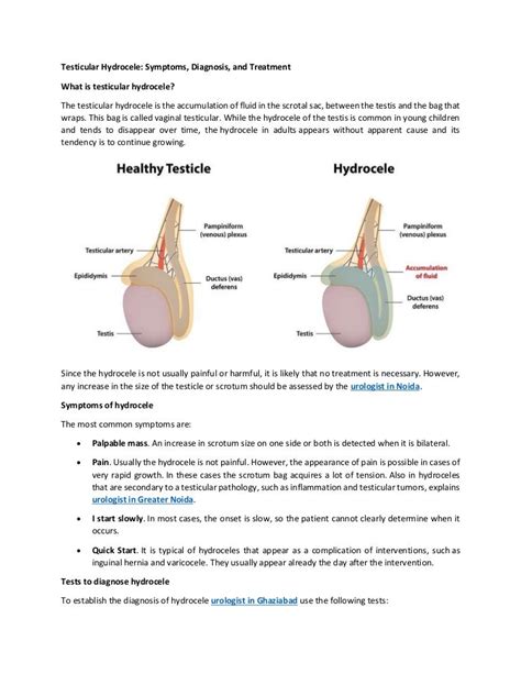 Testicular hydrocele symptoms, diagnosis, and treatment