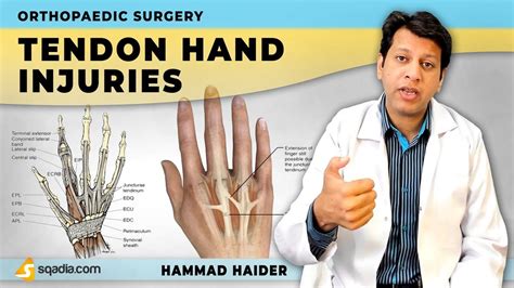 Tendon Hand Injuries | Flexor and Extensor | Orthopaedic Surgery Lectures | V-Learning™ - YouTube