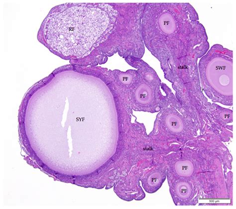 Ovary Gland Histology