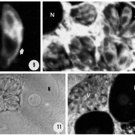 Confocal laser scanning microscopy of Vero cells and tachyzoites of T.... | Download Scientific ...