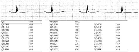 Prolonged Qt Interval Corrected For Heart Rate During