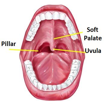 Uvula | News | Dentagama