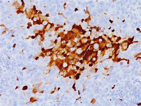 HIF-1 alpha Antibody - Biocare Medical