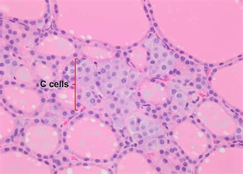 Thyroid gland – Veterinary Histology