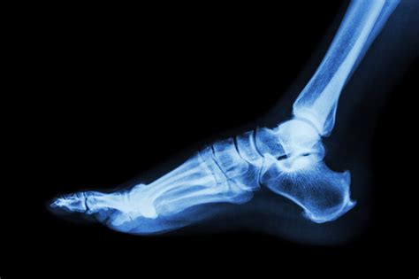 4 Different Types Of Imaging Tests For Foot Conditions - The Orthopaedic Foot & Ankle Center