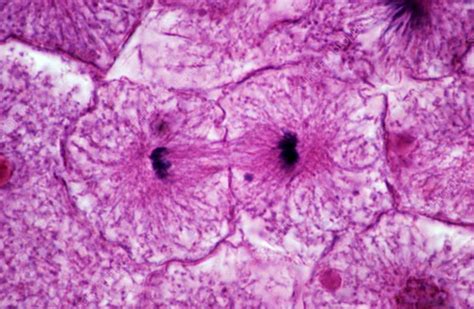 Middle telophase of mitosis, LM - Stock Image - P673/0079 - Science Photo Library
