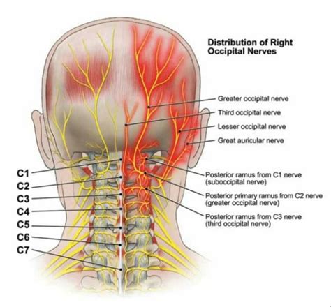 Pin by Colleen Archbold on Ehlers danlos | Neuralgia, Occipital ...