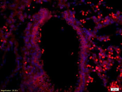 Myelin Protein Zero Antibody (BS-0337R)