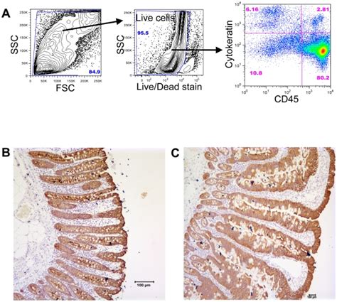 (A) Representative expression of cytokeratin (CK; epithelial cell ...