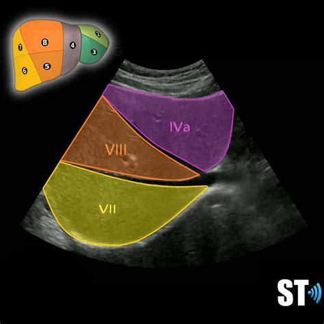 Couinaud’s Liver Segments – Sonographic Tendencies | Diagnostic medical ...