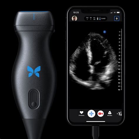 Portable Ultrasound Company Butterfly Network Raises $250 Million