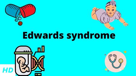 Edwards Syndrome Adults