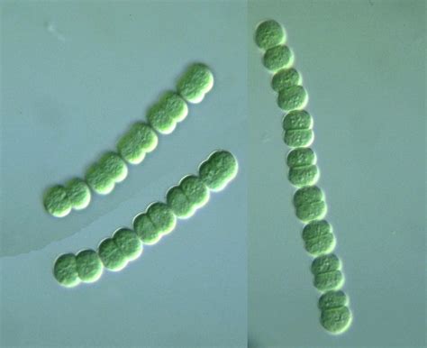 Cyanobacteria: Anabaena