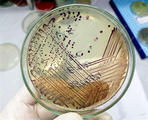 Premium Photo | Bacteria colony of Escherichia coli or Ecoli in culture media plate